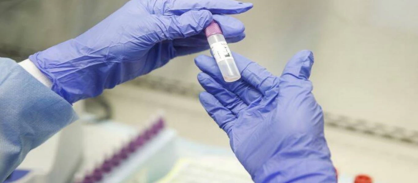 Πόσα τεστ κορωνοϊού έγιναν σήμερα και έπεσαν τόσο τα κρούσματα - Πού βρίσκεται ο δείκτης θετικότητας